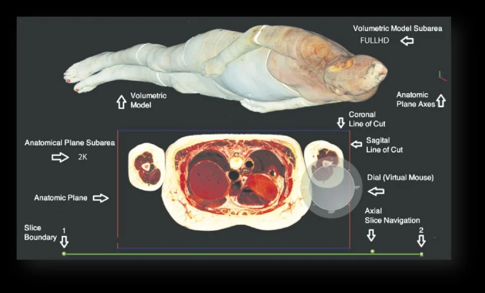 Tecnologia da PUCPR para o ensino de anatomia é destaque na ExpoLondrina 2022